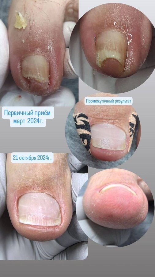 Динамика коррекции по месяцам